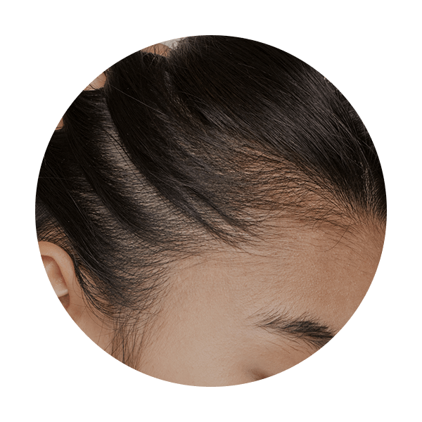 Dry Hair