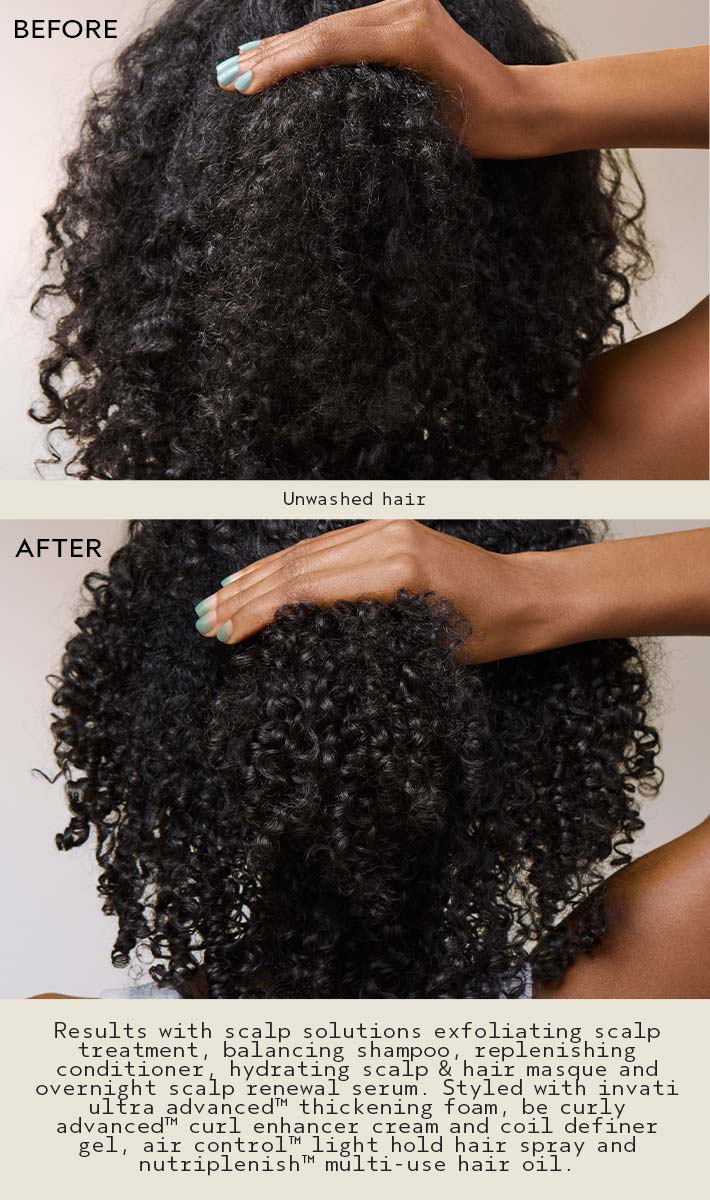 Scalp Solutions Exfoliating Scalp Treatment